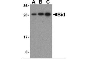 Western Blotting (WB) image for anti-BH3 Interacting Domain Death Agonist (BID) (C-Term) antibody (ABIN1030296) (BID 抗体  (C-Term))