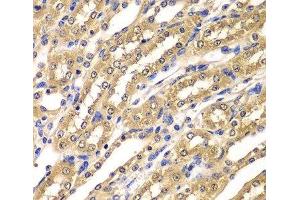 Immunohistochemistry of paraffin-embedded Mouse kidney using UBA3 Polyclonal Antibody at dilution of 1:100 (40x lens). (UBA3 抗体)
