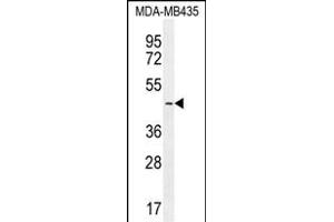 LEF1 Antibody (N-term) (ABIN655987 and ABIN2845371) western blot analysis in MDA-M cell line lysates (35 μg/lane). (LEF1 抗体  (N-Term))