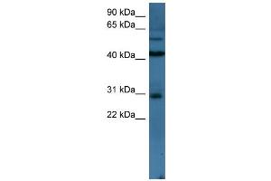 WB Suggested Anti-TLX2 Antibody Titration: 0. (TLX2 抗体  (N-Term))
