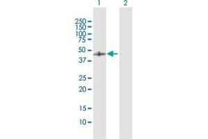 Western Blot analysis of GCDH expression in transfected 293T cell line by GCDH MaxPab polyclonal antibody. (GCDH 抗体  (AA 1-438))