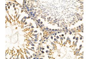 ABIN6256980 and ABIN6274218 at 1/100 staining Rat testis tissue by IHC-P. (Calreticulin 抗体  (N-Term))