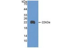 Detection of Recombinant GADD45b, Human using Polyclonal Antibody to Growth Arrest And DNA Damage Inducible Protein Beta (GADD45b) (GADD45B 抗体  (AA 1-160))
