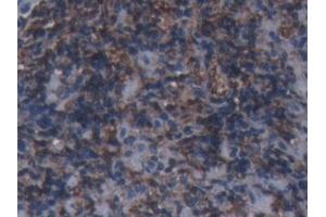 Immunohistochemistry (IHC) image for anti-Ferritin, Heavy Polypeptide 1 (FTH1) (AA 1-181) antibody (ABIN7440041)