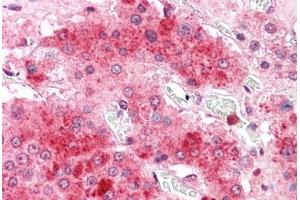 Human Adrenal: Formalin-Fixed, Paraffin-Embedded (FFPE) (COMT 抗体  (C-Term))