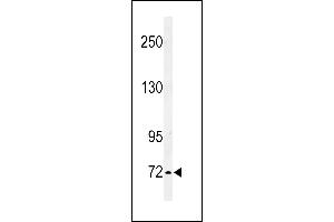 Western blot analysis of IL1RL2 Antibody (Center) 8817c in K562 cell line lysates (35 μg/lane).