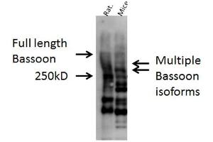 Western blot analysis of Mouse, Rat brain cell lysates showing detection of Bassoon protein using Rabbit Anti-Bassoon Polyclonal Antibody . (Bassoon 抗体  (AA 786-1041))