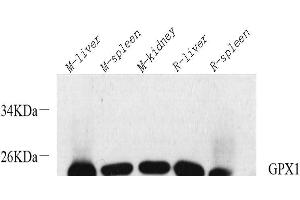 Western Blot analysis of various samples using GPX1 Polyclonal Antibody at dilution of 1:1000. (Glutathione Peroxidase 1 抗体)