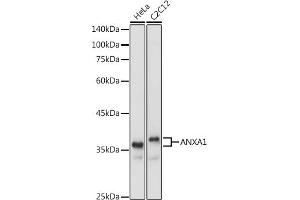 Western blot analysis of extracts of various cell lines, using  antibody (ABIN6133581 and ABIN6136917) at 1:1000 dilution. (Annexin a1 抗体)