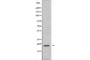 Western blot analysis of extracts from HepG2 cells using RPL12 antibody.