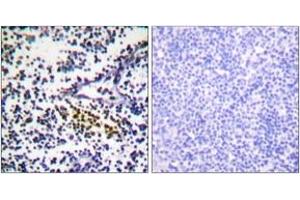 Immunohistochemistry analysis of paraffin-embedded human tonsil tissue, using NYREN18 Antibody. (NUB1 抗体  (AA 566-615))