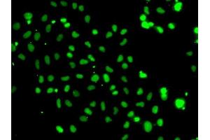 Immunofluorescence analysis of A-549 cells using HMG20A antibody (ABIN6130458, ABIN6141856, ABIN6141857 and ABIN6223115). (HMG20A 抗体  (AA 1-347))