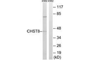Western blot analysis of extracts from K562 cells, using CHST8 Antibody. (CHST8 抗体  (AA 341-390))