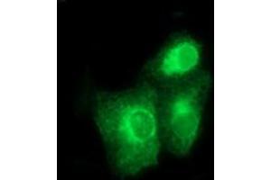Image no. 2 for anti-Bone Morphogenetic Protein 1 (BMP1) (AA 225-617) antibody (ABIN1491232) (BMP1 抗体  (AA 225-617))