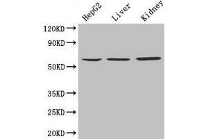 Western Blot Positive WB detected in: HepG2 whole cell lysate, Mouse liver tissue, Mouse kidney tissue All lanes: NAPRT antibody at 4 μg/mL Secondary Goat polyclonal to rabbit IgG at 1/10000 dilution Predicted band size: 58, 61, 57 kDa Observed band size: 58 kDa (NAPRT1 抗体  (AA 1-310))
