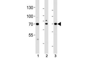 Western Blotting (WB) image for anti-Activating Transcription Factor 6 beta (ATF6B) (AA 560-589) antibody (ABIN3029852)