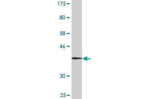 Western Blot detection against Immunogen (36. (DPYSL2 抗体  (AA 470-571))