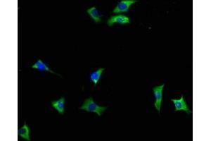 Immunofluorescence staining of SH-SY5Y cells with ABIN7140040 at 1:133, counter-stained with DAPI. (INPP5F 抗体  (AA 187-204))