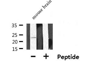 Western Blotting (WB) image for anti-Phosphatidylethanolamine Binding Protein 1 (PEBP1) (C-Term) antibody (ABIN6264127)
