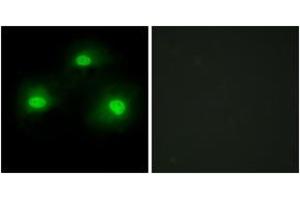 Immunofluorescence analysis of HeLa cells, using IPKA Antibody. (PKIA 抗体  (AA 10-59))