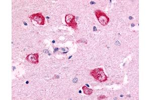 Anti-PAK7 antibody IHC of human brain, thalamus neurons. (PAK7 抗体  (Internal Region))