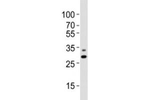 Western Blotting (WB) image for anti-Prohibitin (PHB) (N-Term) antibody (ABIN3028946)