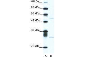 WB Suggested Anti-ATF4 Antibody Titration:  5. (ATF4 抗体  (C-Term))