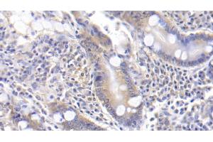 Detection of TFPI in Human Small intestine Tissue using Polyclonal Antibody to Tissue Factor Pathway Inhibitor (TFPI) (TFPI 抗体  (AA 29-210))