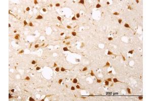 Immunoperoxidase of monoclonal antibody to ELAVL4 on formalin-fixed paraffin-embedded human cerebral cortex.