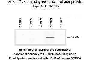 Image no. 2 for anti-Dihydropyrimidinase-Like 3 (DPYSL3) (C-Term) antibody (ABIN347041) (DPYSL3 抗体  (C-Term))