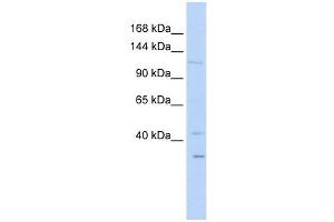 WWP1 antibody used at 1 ug/ml to detect target protein. (WWP1 抗体  (N-Term))