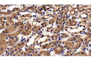Immunohistochemistry (IHC) image for anti-Furin (Paired Basic Amino Acid Cleaving Enzyme) (FURIN) (AA 418-573) antibody (ABIN7437320)