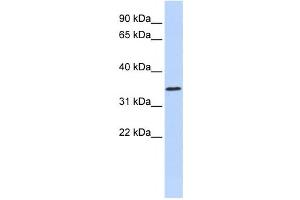 Western Blotting (WB) image for anti-Zinc Finger Protein 660 (ZNF660) antibody (ABIN2458227) (ZNF660 抗体)