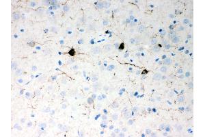 Anti- Neuropeptide Y Picoband antibody,IHC(P) IHC(P): Rat Brain Tissue (NPY 抗体  (Middle Region))
