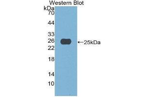 Western Blotting (WB) image for anti-APOBEC1 Complementation Factor (A1CF) (AA 389-587) antibody (ABIN1980366) (A1CF 抗体  (AA 389-587))
