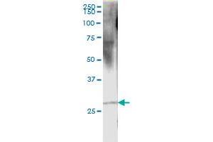 Immunoprecipitation of RCVRN transfected lysate using rabbit polyclonal anti-RCVRN and Protein A Magnetic Bead ( U0007 ), and immunoblotted with mouse purified polyclonal anti-RCVRN.