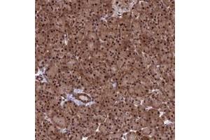 Immunohistochemical staining of human pancreas with C14orf166 polyclonal antibody  shows strong nuclear and cytoplasmic positivity in exocrine glandular cells at 1:200-1:500 dilution. (C14orf166 抗体)
