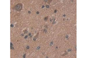 IHC-P analysis of Human Tissue, with DAB staining. (BCL11A 抗体  (AA 1-210))
