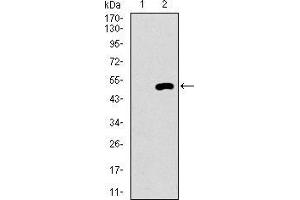 Western blot analysis using EGFR mutant mAb against HEK293 (1) and EGFR mutant (AA: 693-893)-hIgGFc transfected HEK293 (2) cell lysate. (EGFR Mutant (AA 693-893), (Mutant) 抗体)