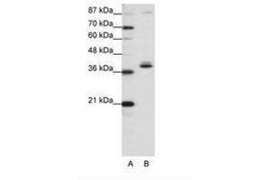 Image no. 1 for anti-Zinc Finger Protein 25 (ZNF25) (C-Term) antibody (ABIN203079) (ZNF25 抗体  (C-Term))