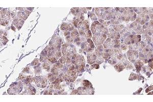 ABIN6273223 at 1/100 staining Human pancreas cancer tissue by IHC-P. (PPIC 抗体  (Internal Region))