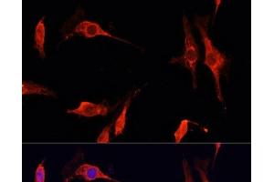 Immunofluorescence analysis of C6 cells using DNASE1 Polyclonal Antibody at dilution of 1:100 (40x lens). (DNASE1 抗体)