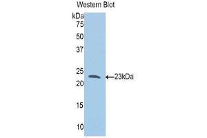 Western Blotting (WB) image for anti-Slit Homolog 1 (SLIT1) (AA 647-835) antibody (ABIN3204490) (SLIT1 抗体  (AA 647-835))