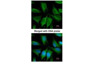 ICC/IF Image Immunofluorescence analysis of paraformaldehyde-fixed HeLa, using FGD4, antibody at 1:200 dilution. (FGD4 抗体)