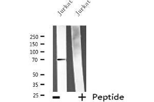 Western blot analysis of extracts from Jurkat cells, using ATG16L1 antibody.