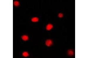 Immunofluorescent analysis of Glucocorticoid Receptor staining in PC12 cells. (Glucocorticoid Receptor 抗体)