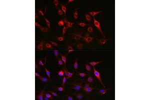 Immunofluorescence analysis of C6 cells using FAK Rabbit pAb (ABIN3022950, ABIN3022951, ABIN3022952 and ABIN6219313) at dilution of 1:100 (40x lens). (FAK 抗体)