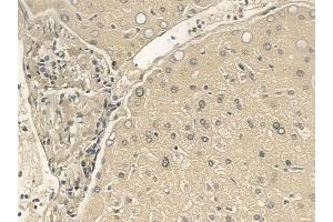 ABIN6265727 and ABIN6273334 at 1/100 staining human normal liver tissue by IHC-P.