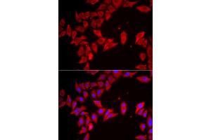 Immunofluorescence analysis of HeLa cells using SLC35A2 antibody (ABIN5974358). (SLC35A2 抗体)