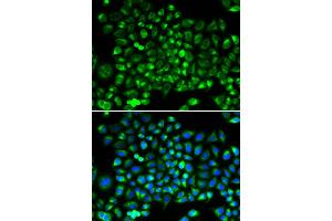 Immunofluorescence analysis of HeLa cells using DNM1L antibody (ABIN5971410). (Dynamin 1-Like 抗体)